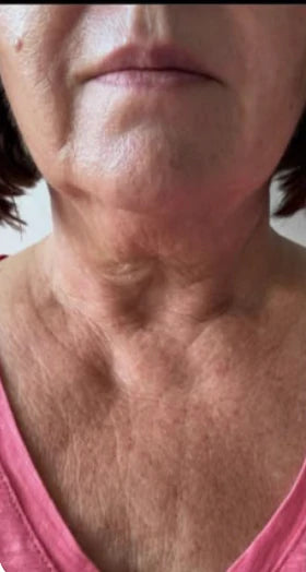Linda, 64