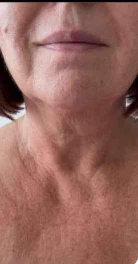 Linda, 64