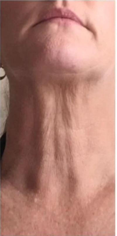 Patricia, 55