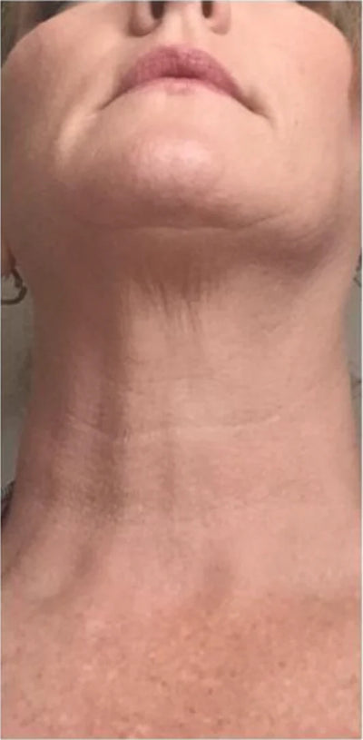 Patricia, 55