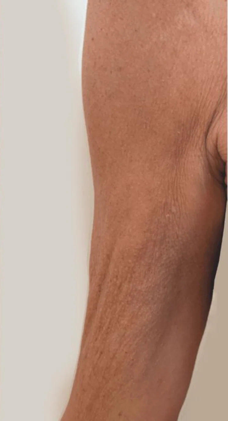 After image treatment comparison